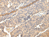 Anti-Human/Mouse/Rat SDCBP Antibody - ABMIUM