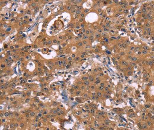 Anti-Human HMGCS1 Antibody