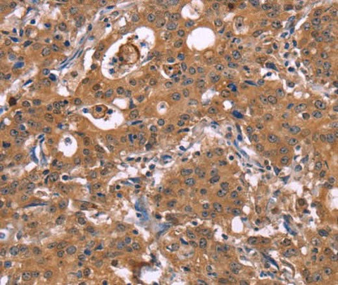 Anti-Human HMGCS1 Antibody - ABMIUM