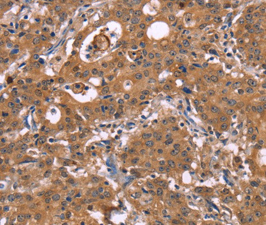 Anti-Human HMGCS1 Antibody - ABMIUM
