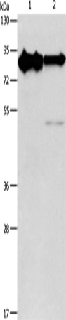 Anti-Human/Mouse KIF3A Antibody - ABMIUM