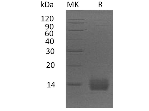 Recombinant Human Apolipoprotein A2/ApoA2 Protein (His Tag) - ABMIUM