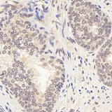 Immunohistochemistry analysis of paraffin-embedded human Prostate using AR Polyclonal Antibody at dilution of 1:300.