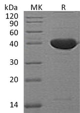 Recombinant Mouse Serpin F1/PEDF Protein - ABMIUM