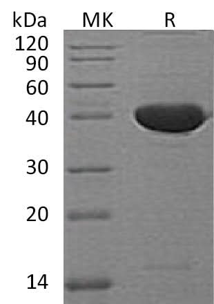 Recombinant Mouse Serpin F1/PEDF Protein - ABMIUM