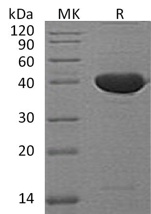 Recombinant Mouse Serpin F1/PEDF Protein - ABMIUM
