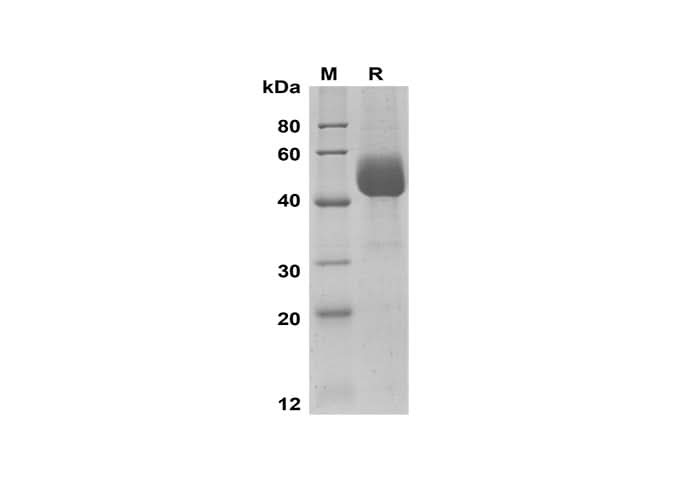 SDS-PAGE analysis of Human GLA proteins, 2 μg/lane of Recombinant Human GLA proteins was resolved with SDS-PAGE under reducing conditions, showing bands at 42-60 kDa.