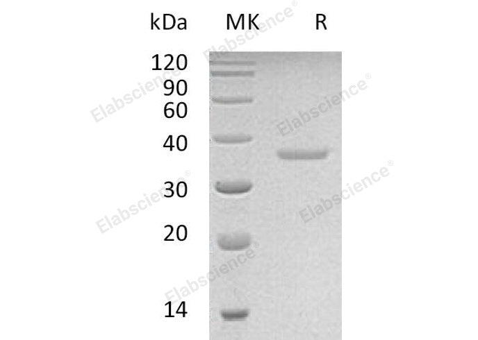 Recombinant Human PRPS2 Protein (His Tag) - ABMIUM