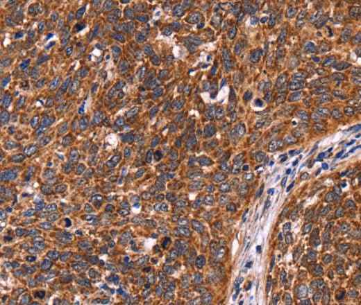 Anti-Human/Mouse CCDC106 Antibody
