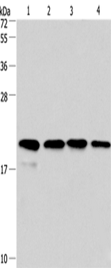 Anti-Human/Mouse/Rat Cyclophilin F Antibody - ABMIUM
