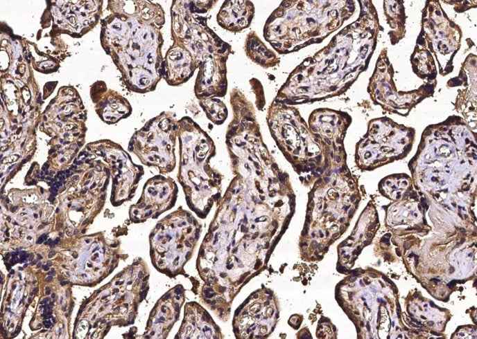 Anti-Human NECTIN3 Antibody [A1040] - ABMIUM