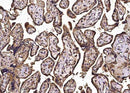 Anti-Human NECTIN3 Antibody [A1040] - ABMIUM
