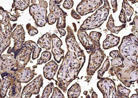Anti-Human NECTIN3 Antibody [A1040] - ABMIUM