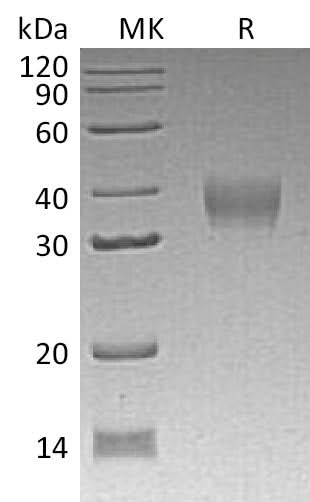 Recombinant Mouse LILRB4/CD85k/ILT3 Protein (His Tag) - ABMIUM