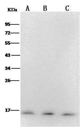 Anti-Human PFDN1 Antibody [A995] - ABMIUM