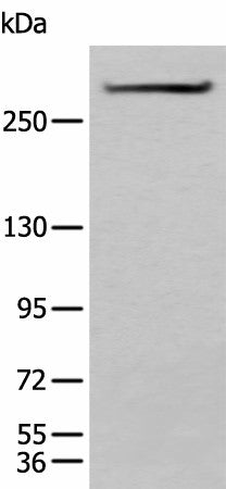 Western blot analysis of Mouse heart tissue lysate using SPTA1 Polyclonal Antibody at dilution of 1:550