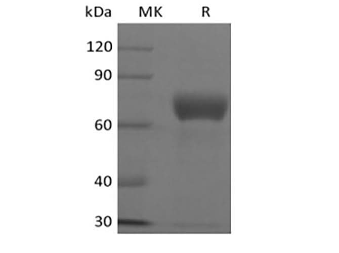 Recombinant Human TSLP R/CRLF2 (C-Fc) - ABMIUM