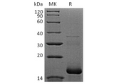 Recombinant Human APOB/Apolipoprotein B-100 Protein (His Tag) - ABMIUM