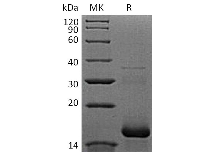 Recombinant Human APOB/Apolipoprotein B-100 Protein (His Tag) - ABMIUM