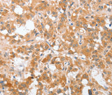 Anti-Human/Mouse/Rat cPLA2 Antibody - ABMIUM