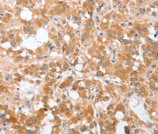 Anti-Human/Mouse/Rat cPLA2 Antibody