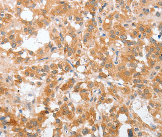 Anti-Human/Mouse/Rat cPLA2 Antibody - ABMIUM