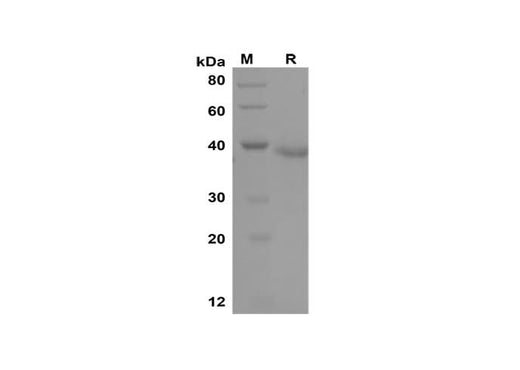 SDS-PAGE analysis of Mouse IL-10 proteins, 2 μg/lane of Recombinant Mouse IL-10 proteins was resolved with SDS-PAGE under reducing conditions, showing bands at 38 kDa.