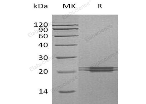 Recombinant Human FAM3C Protein (His Tag) - ABMIUM