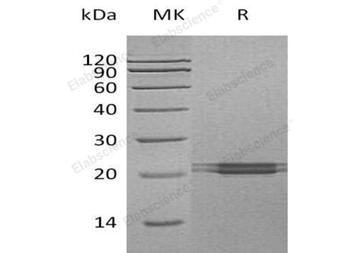 Recombinant Human FAM3C Protein (His Tag) - ABMIUM
