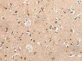 Immunohistochemistry of paraffin-embedded Human brain tissue using DYNAP Polyclonal Antibody at dilution of 1:50(×200)