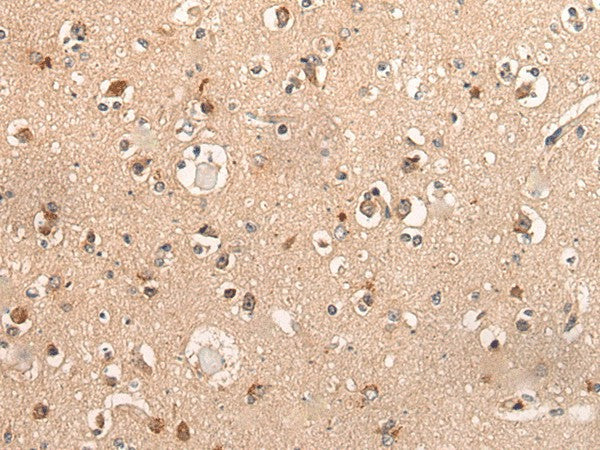 Immunohistochemistry of paraffin-embedded Human brain tissue using DYNAP Polyclonal Antibody at dilution of 1:50(×200)
