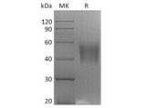 Recombinant Rhesus macaque B7-H4/VTCN1 Protein (His Tag) - ABMIUM