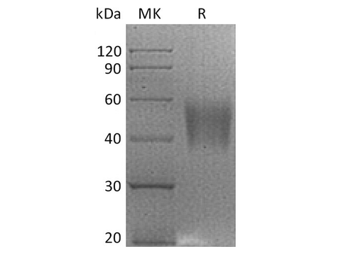 Recombinant Rhesus macaque B7-H4/VTCN1 Protein (His Tag) - ABMIUM