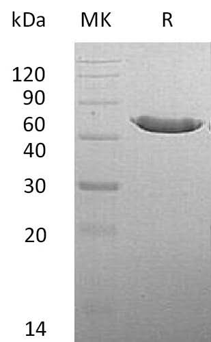 Recombinant Mouse CPA2 Protein (His Tag) - ABMIUM