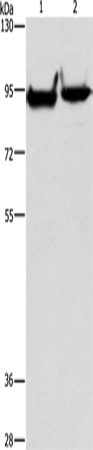 Anti-Human/Mouse/Rat MARK1 Antibody - ABMIUM