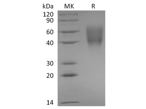 Recombinant Rabbit B7-2/CD86 Protein (His Tag) - ABMIUM