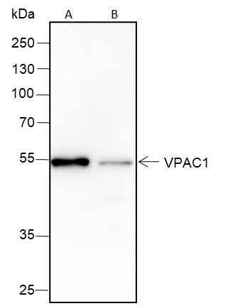 Anti-Human/Rat/Mouse VPAC1 Antibody [A390] - ABMIUM