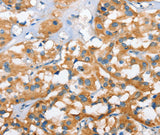 Anti-Human CXCL14 Antibody - ABMIUM