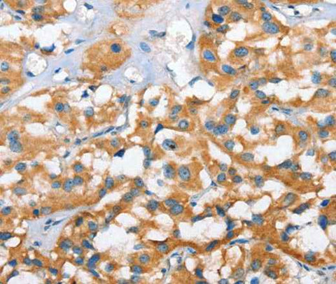 Anti-Human CXCL14 Antibody