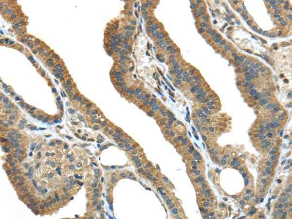 Anti-Human/Mouse TMPRSS13 Antibody