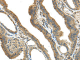 Anti-Human/Mouse TMPRSS13 Antibody - ABMIUM