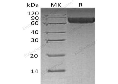 Recombinant Human LILRB2/CD85d Protein (His Tag) - ABMIUM