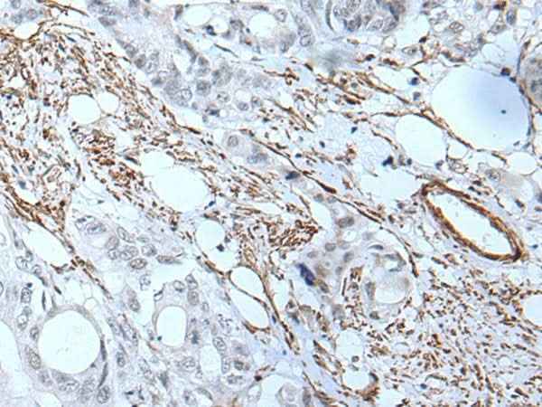 Anti-Human GJA5 Antibody