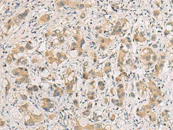 Anti-Human RTP4 Antibody