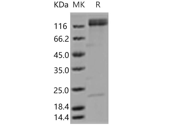 Recombinant Human ITGA5 & ITGB1 Heterodimer Protein - ABMIUM
