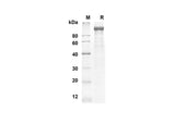 SDS-PAGE analysis of Mouse LEPR proteins, 2 μg/lane of Recombinant Mouse LEPR proteins was resolved with an SDS-PAGE under reducing conditions, showing bands at 89.9 kDa.