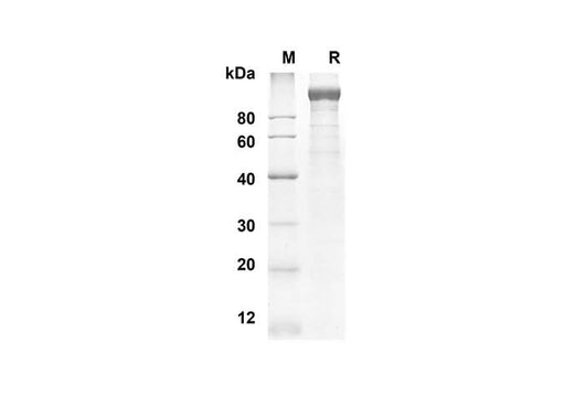SDS-PAGE analysis of Mouse LEPR proteins, 2 μg/lane of Recombinant Mouse LEPR proteins was resolved with an SDS-PAGE under reducing conditions, showing bands at 89.9 kDa.