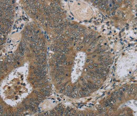 Anti-Human HSD3B1 Antibody