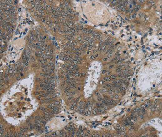 Anti-Human HSD3B1 Antibody