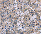 Anti-Human EID1 Antibody - ABMIUM